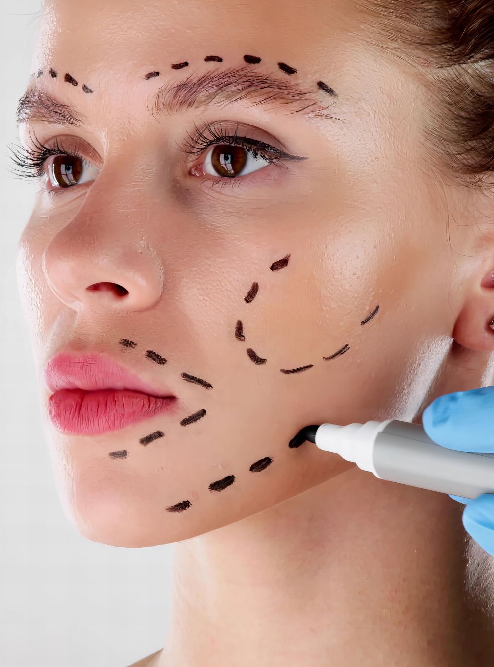 medicia viso estetica