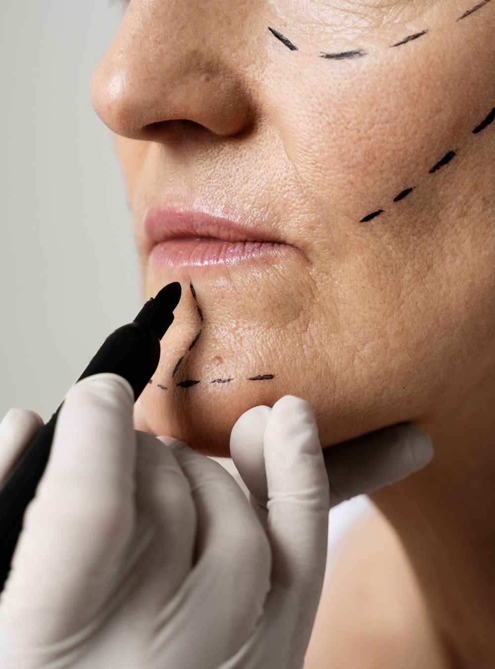 viso labbra estetica